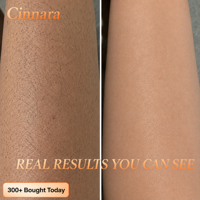 6-in-1 Hair Removal Complex