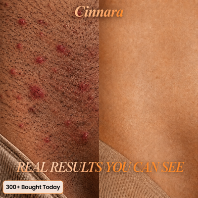 6-in-1 Hair Removal Complex