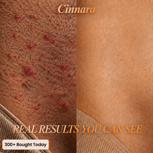 6-in-1 Hair Removal Complex